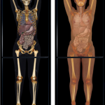 Virtual Dissection, Web and Mobile Device Enabled Apps Offer New Ways of Learning, Practicing Medical Sciences